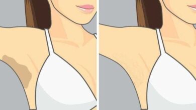 5 remédios caseiros para clarear as axilas escuras