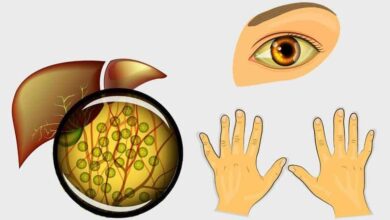 5 sintomas que podem indicar que você está com o fígado doente