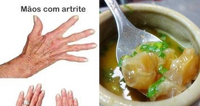 7 Benefícios SURPREENDENTE do caldo de mocotó