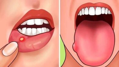 7 Sinais de que o seu corpo tem deficiência de potássio