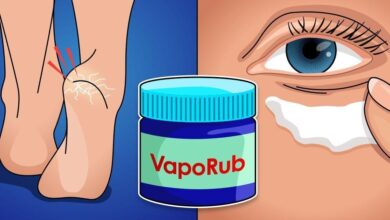 8 Utilidades do Vick Vaporub que você não conhece