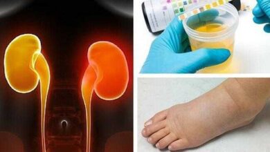 8 sintomas cruciais de insuficiência renal que a maioria das pessoas ignora