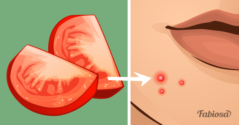 2-apply_tomatoes_to_your_fa