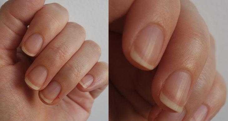 Como remover as cutículas sem alicate em 5 minutos