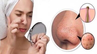 Como tirar cravos pretos do rosto