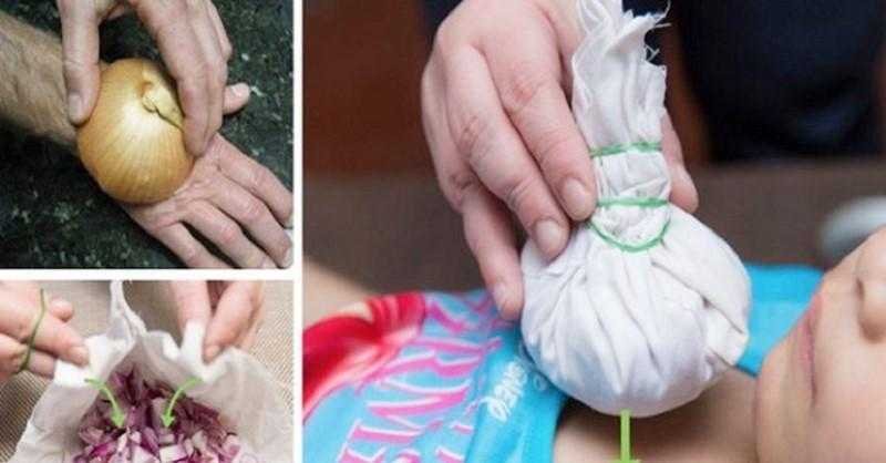 Como usar a cebola para tratar 9 doenças comuns no dia-a-dia