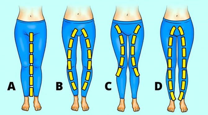 Diga como são suas pernas