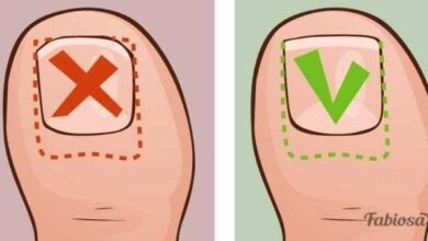 Ela sofria com unhas encravadas por vários anos até que aprendeu essas dicas simples