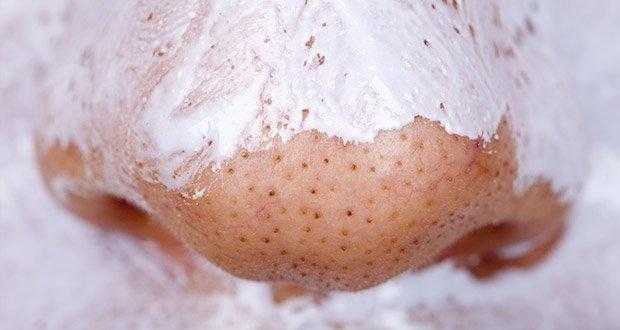 Elimine cravos e espinhas rapidamente com estas 3 receitas caseiras