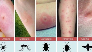Foi picado por algo e não sabe o que é? Veja como identificar as 8 picadas mais comuns
