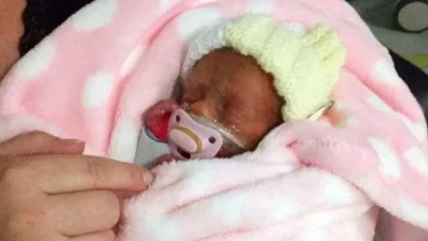 Médicos presenciam milagre ao ver recém-nascida de apenas 450 gramas respirar sem ajuda de aparelhos