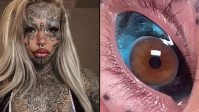 Mulher que ficou cega por causa de tinta no globo ocular recebe a tatuagem
