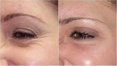 Poderosa máscara caseira antirrugas | Bau das DICAS