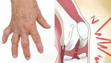 Por que não devemos estalar os dedos?