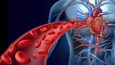 Receita contra artérias entupidas | Bau das DICAS
