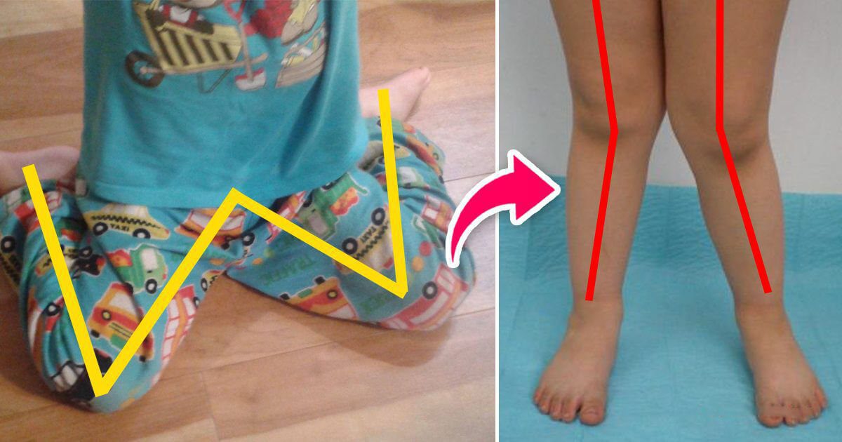 Se seu filho quer se sentar nessa posição, não deixe! O motivo? Você não faz ideia.