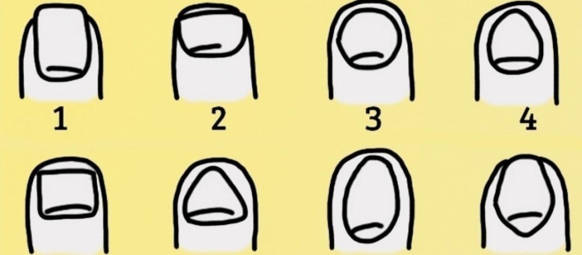 Veja Como É Sua Personalidade Olhando As Formas Das Suas Unhas