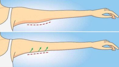 Aprenda maneiras simples de reduzir a gordura do braço 1