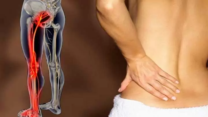 como eliminar a dor no nervo ciático rápido!