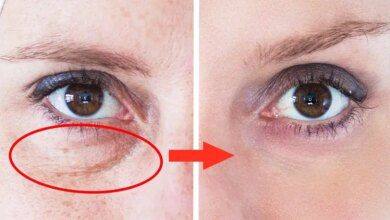 Como eliminar olheiras | Bau das DICAS