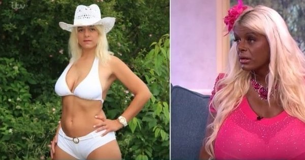mulher-viciada-em-plasticas_1
