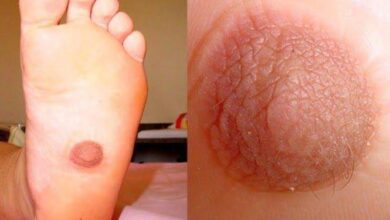 10 das mais bizarras anomalias genéticas em humanos