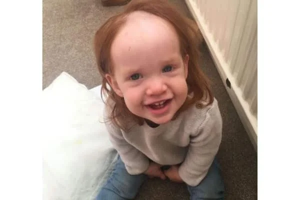 1602939857 519 Menina confunde gel de cabelo com creme depilatorio e o