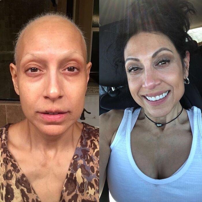 1634763930 692 22 Fotos de antes e depois que sao incrivelmente satisfatorias