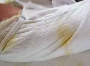 1550952621 975 ENFERMEIRA AMARRA BEBE DE 5 MESES NA CAMA DO HOSPITAL