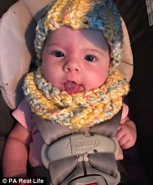 1492032482 300 bebe passa por transformacao impressionante apos tratamento para manchas