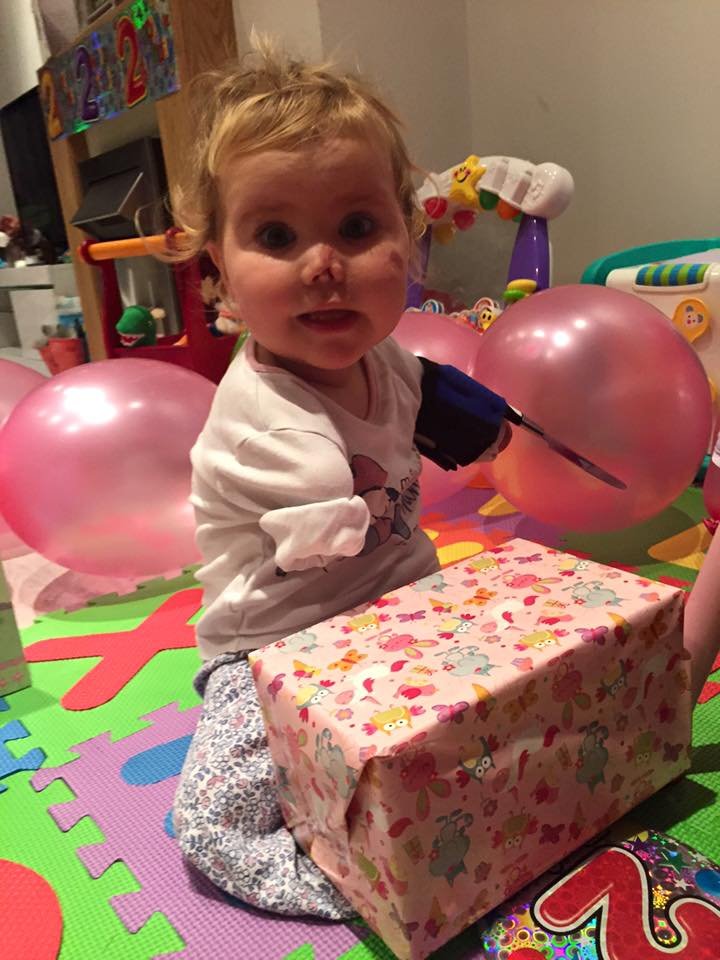1497277427 493 ao completar 11 meses essa garotinha comecou a apodrecer viva voce precisa ver o motivo