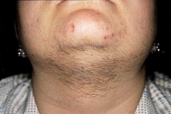 1504385328 127 6 sinais que nao devem ser ignorados se voce tem pelos no