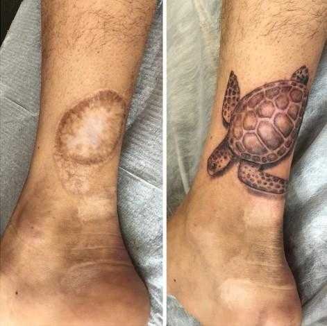 11 Tatuagens que transformam cicatrizes indesejadas em arte kl 5