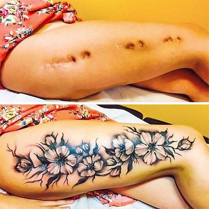 11 Tatuagens que transformam cicatrizes indesejadas em arte kl 8