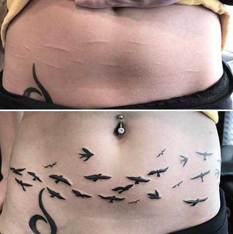 11 Tatuagens que transformam cicatrizes indesejadas em arte kl 11
