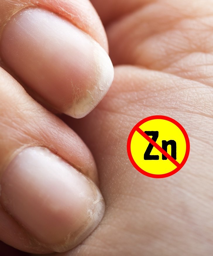 7Coisas que asmãos podem revelar sobre sua saúde