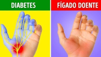 6 Coisas que as mãos podem revelar sobre sua saúde
