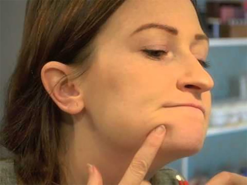 1504385328 183 6 sinais que nao devem ser ignorados se voce tem pelos no