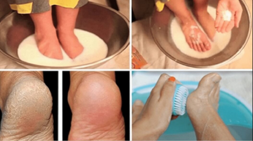 Adeus rachaduras, pés macios e bem curados