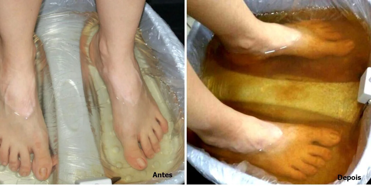 Como desintoxicar o corpo através de banhos de pés