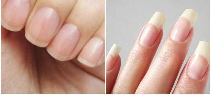 Como fazer a unha crescer mais rápido com receitas caseiras 1a