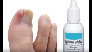 DIPIRONA para Acabar com Micose de Unha – Como Acabar com a MICOSE
