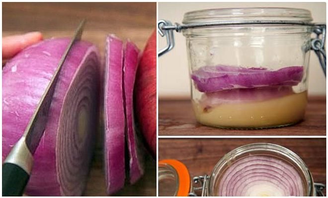 Essa receita natural trata diabetes bronquite asma entupimento nas veias