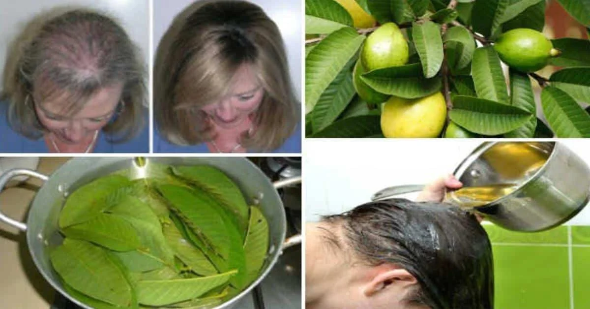 Folhas de goiaba, faz parar de cair o cabelo em até 100% e dá volume