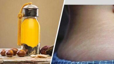Óleo de argan para deixar suas estrias invisíveis